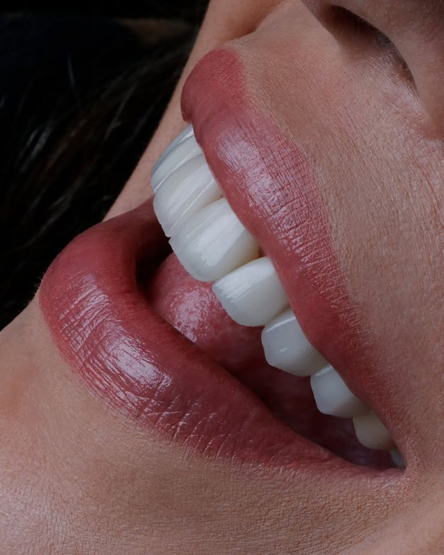 Estética Dental Oral Sin