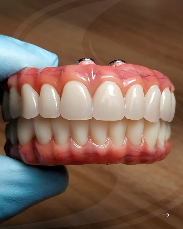 Prótese Protocolo Oral Sin